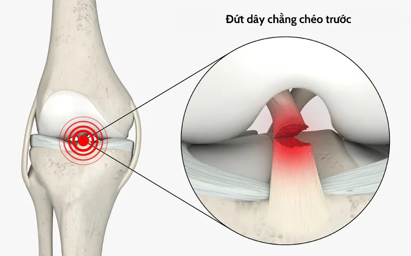 Khám khớp gối